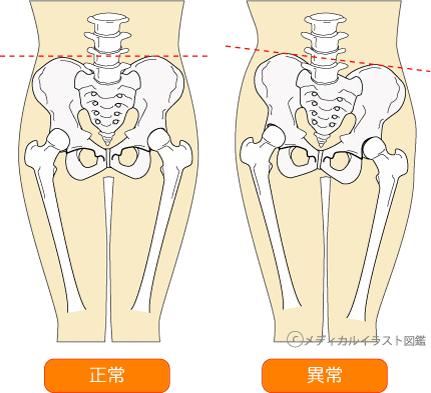 骨盤矯正 産後骨盤矯正のご案内 登米市 東北整体院