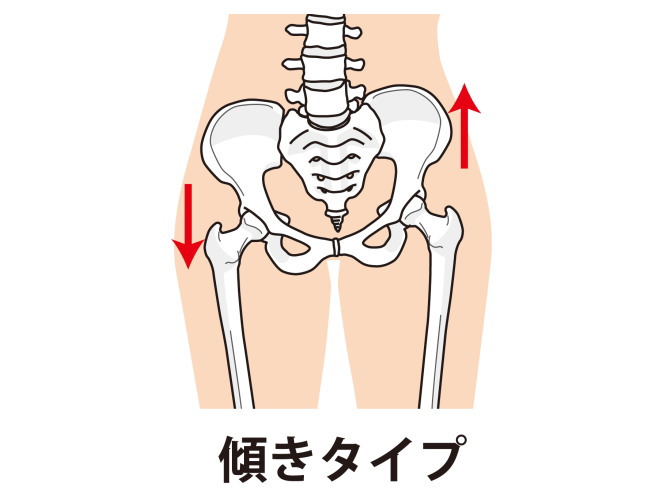 骨盤